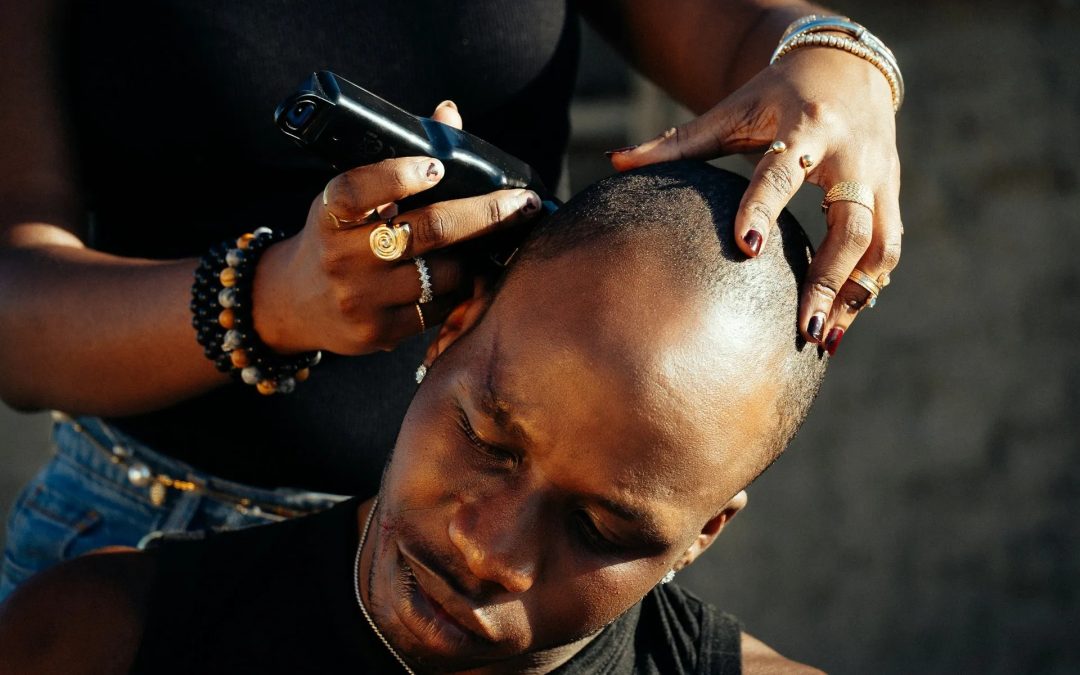 Preventing Dry Scalp After Winter Head Shaves